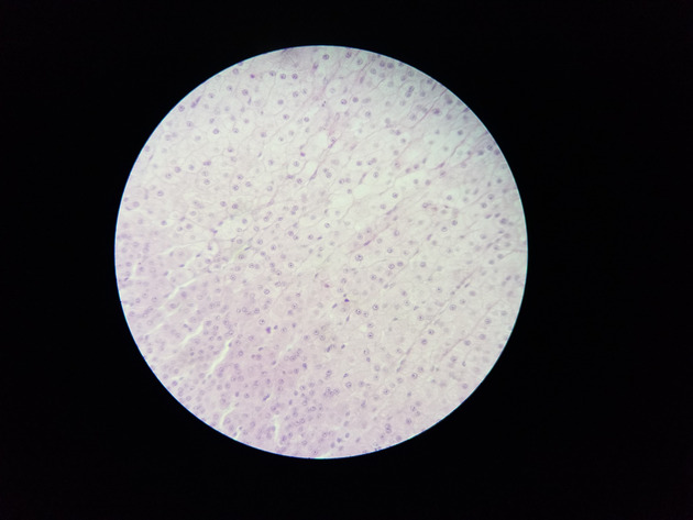 Adrenal Slides - Adrenal 008 100X